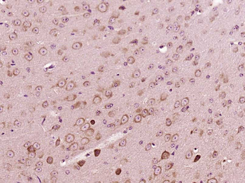 PEX5 Rabbit Polyclonal Antibody