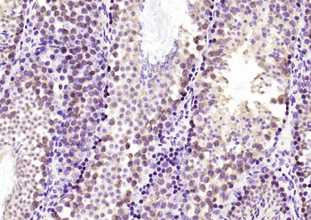 PFDN1 Rabbit Polyclonal Antibody