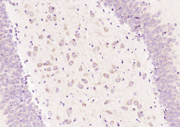 PFDN1 Rabbit Polyclonal Antibody