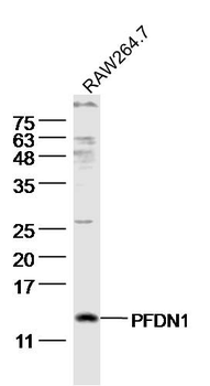 PFDN1 Rabbit Polyclonal Antibody