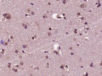 PKD1L2 Rabbit Polyclonal Antibody