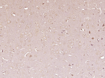 PLCD1/NDNC3 Rabbit Polyclonal Antibody