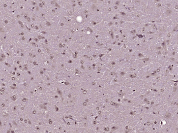 PLK2 Rabbit Polyclonal Antibody