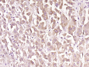 Perforin Rabbit Polyclonal Antibody