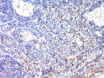 Perforin Rabbit Polyclonal Antibody