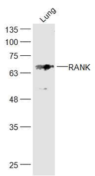 RANK Rabbit Polyclonal Antibody