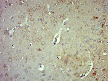 R3HCC1 Rabbit Polyclonal Antibody