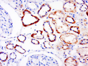RAI14 Rabbit Polyclonal Antibody