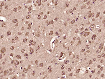 RASGRP3 Rabbit Polyclonal Antibody