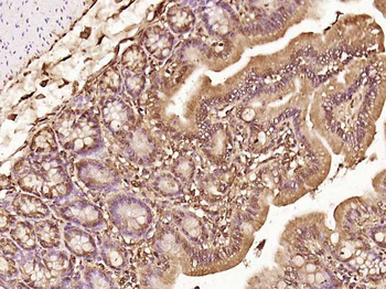 RBM16 Rabbit Polyclonal Antibody