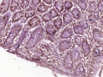 RBM35A/ESRP1 Rabbit Polyclonal Antibody