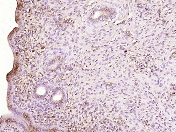 RBM47 Rabbit Polyclonal Antibody