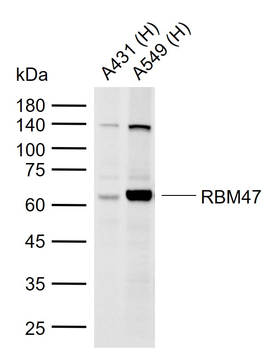 RBM47 Rabbit Polyclonal Antibody