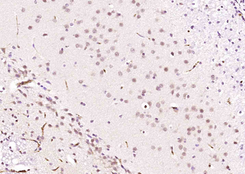 RECQ1 Rabbit Polyclonal Antibody