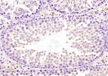 RECQ1 Rabbit Polyclonal Antibody
