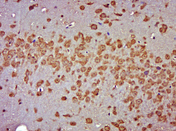 RGS7 Rabbit Polyclonal Antibody