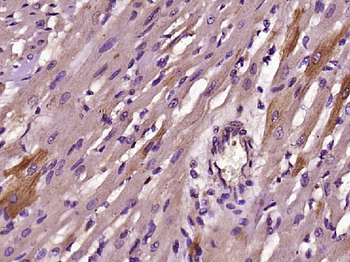 SDPR Rabbit Polyclonal Antibody