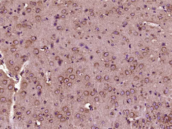 SGSM2 Rabbit Polyclonal Antibody