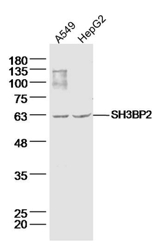 SH3BP2 Rabbit Polyclonal Antibody