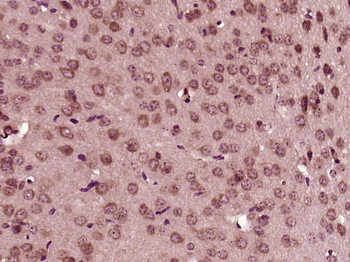 SH3GL2/Endophilin A1 Rabbit Polyclonal Antibody