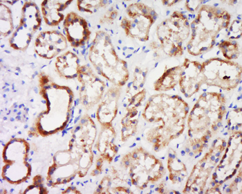 SLC25A26 Rabbit Polyclonal Antibody