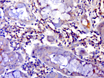 SLC2A13 Rabbit Polyclonal Antibody