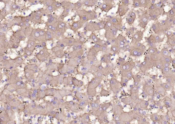 SLC39A14 Rabbit Polyclonal Antibody
