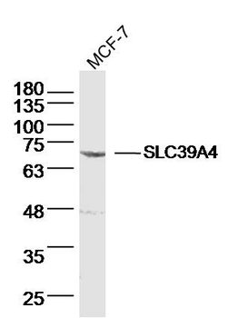 SLC39A4 Rabbit Polyclonal Antibody