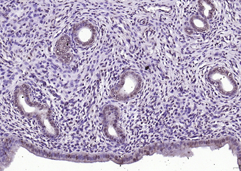 Phospho-Src (Ser75) Rabbit Polyclonal Antibody