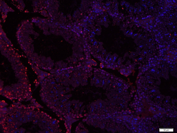 Phospho-Src (Ser75) Rabbit Polyclonal Antibody