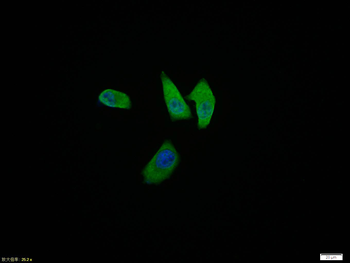 Phospho-Smad3 (Thr179) Rabbit Polyclonal Antibody