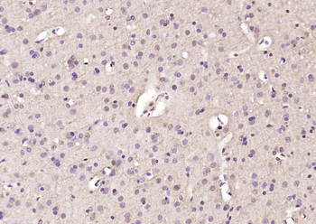 SMARCC1 Rabbit Polyclonal Antibody