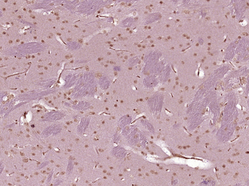 SMCHD1 Rabbit Polyclonal Antibody