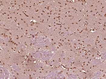 SMCHD1 Rabbit Polyclonal Antibody