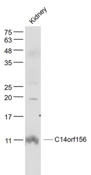 SLIRP/C14orf156 Rabbit Polyclonal Antibody