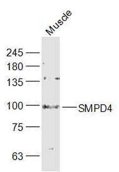 SMPD4 Rabbit Polyclonal Antibody
