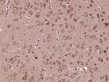 STIM2 Rabbit Polyclonal Antibody