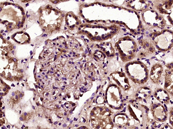 STOX1 Rabbit Polyclonal Antibody