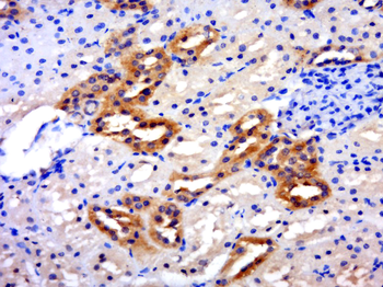SLC26A6 Rabbit Polyclonal Antibody