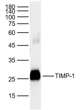 TIMP-1 Rabbit Polyclonal Antibody