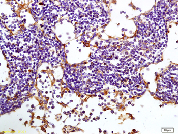 TIMP-1 Rabbit Polyclonal Antibody