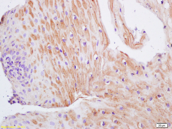 TIMP-1 Rabbit Polyclonal Antibody