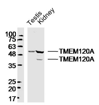 TMEM120A Rabbit Polyclonal Antibody