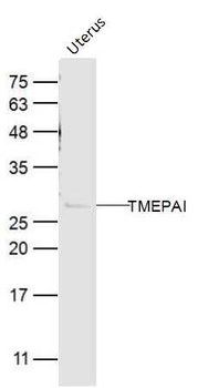 TMEPAI Rabbit Polyclonal Antibody