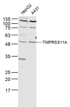 TMPRSS11A Rabbit Polyclonal Antibody