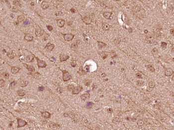 TBC1D15 Rabbit Polyclonal Antibody