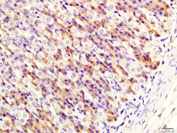 UGT1A7 Rabbit Polyclonal Antibody