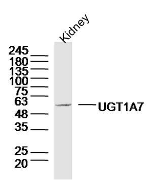 UGT1A7 Rabbit Polyclonal Antibody