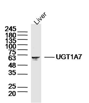 UGT1A7 Rabbit Polyclonal Antibody