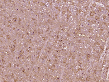 VPS13D Rabbit Polyclonal Antibody